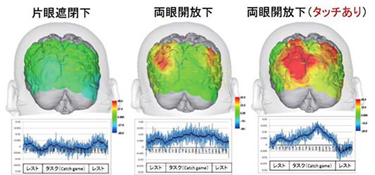 Occlu-pad® のCatch-game 時の後頭葉視覚野の脳血流動態変化