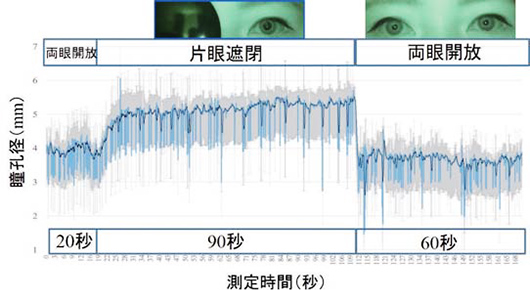 （図2）片眼遮閉、両眼開放における瞳孔径変化
